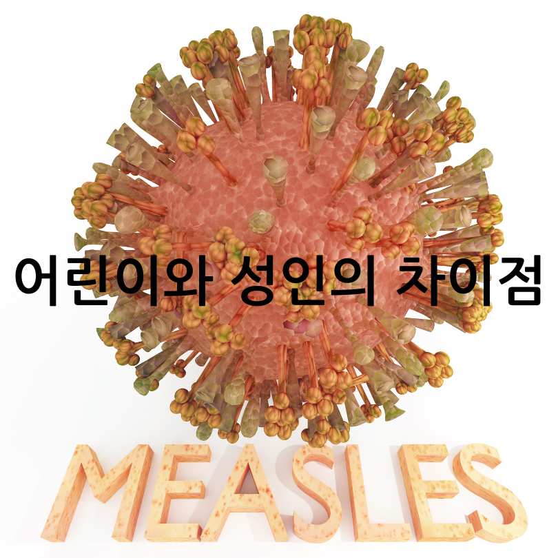 성인 홍역과 어린이 홍역의 차이점