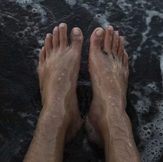 무좀 증상 치료법 원인 발톱 손톱