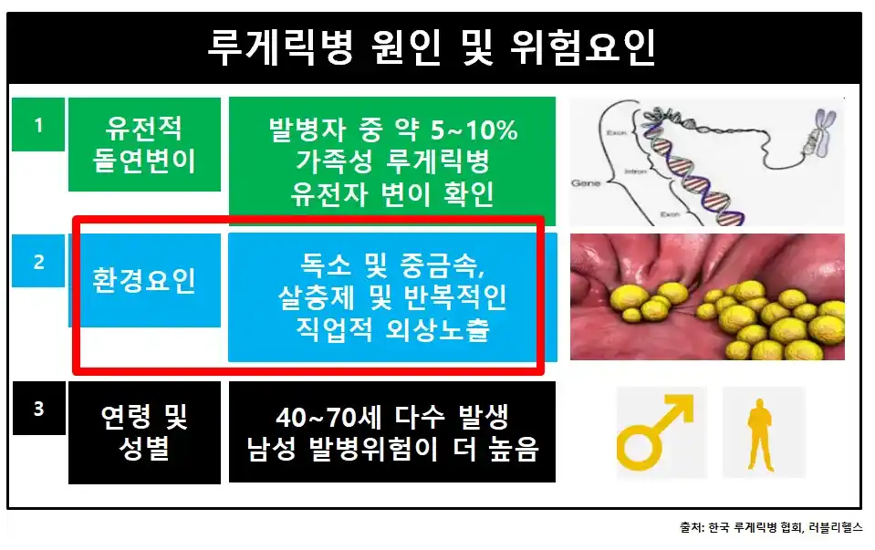 루게릭병원인