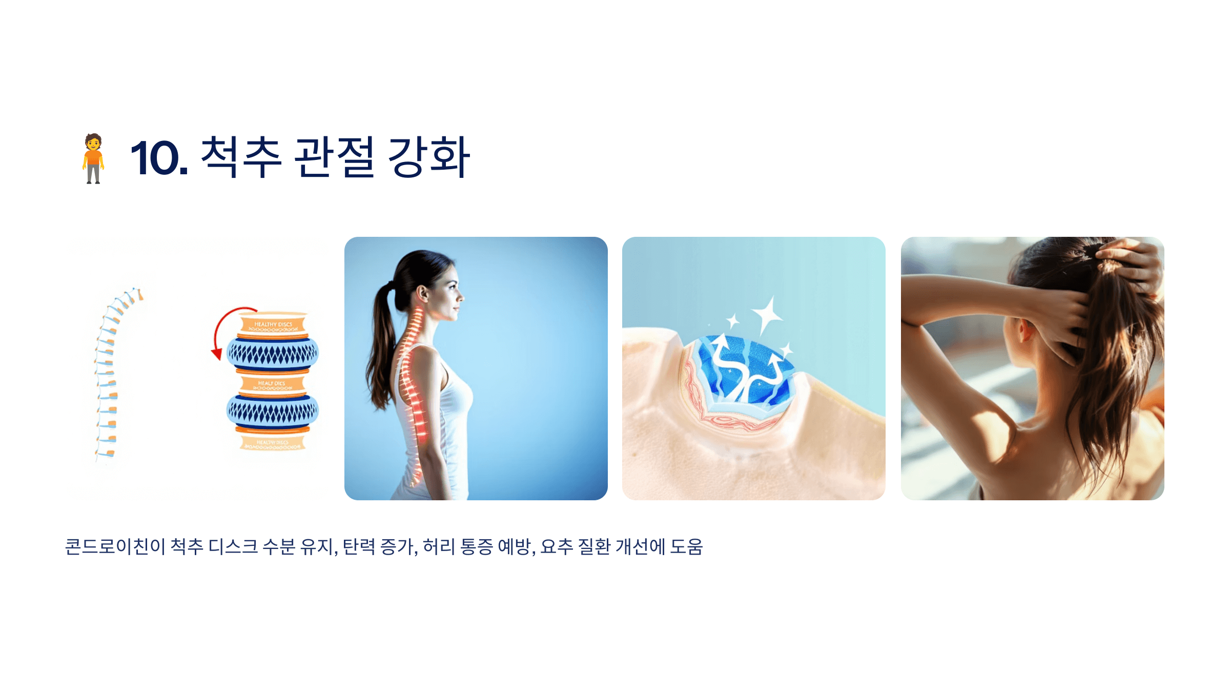 콘드로이친과 관련된 사진입니다.