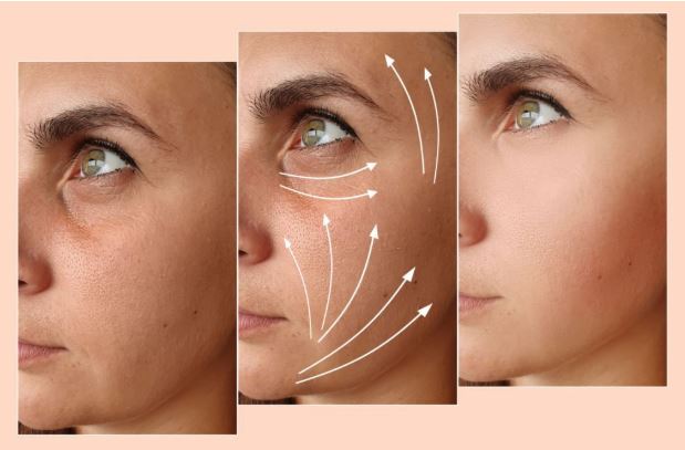 울쎄라 효과 600샷 가격 정보