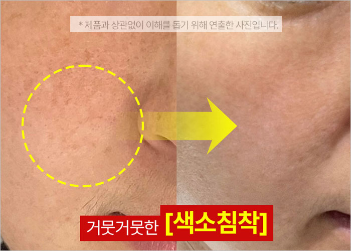 마미케어 율무크림 후기, 효과, 사용법, 부작용