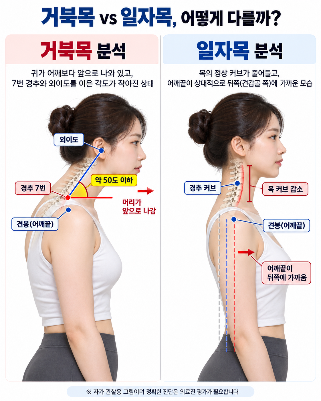 내 목은 거북목일까, 일자목일까? 목 통증 자가진단 5가지