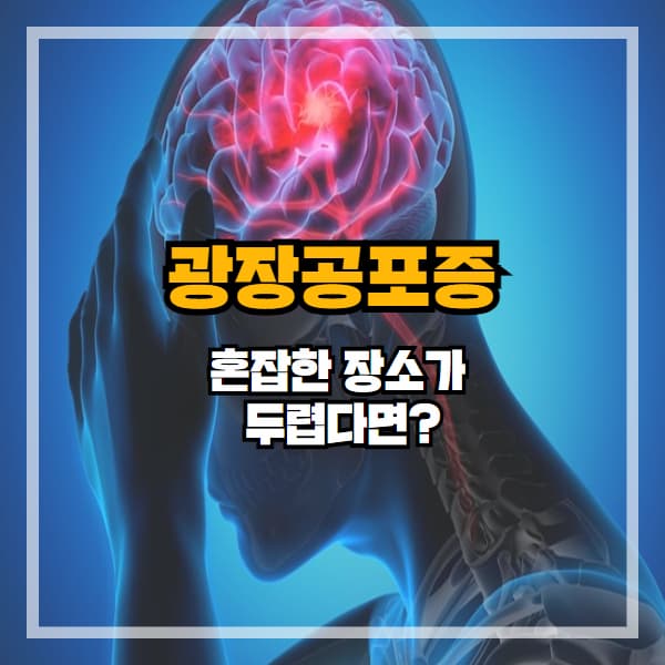 혼잡한 장소가 두렵다면? 광장공포증을 의심해보세요
