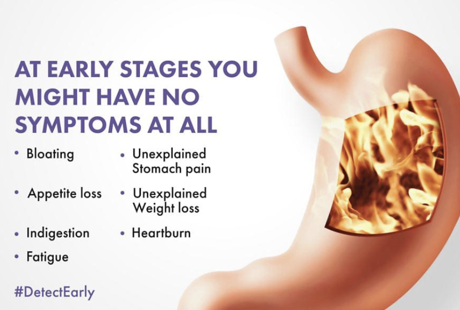 위암 초기증상 12가지 총정리 섬네일