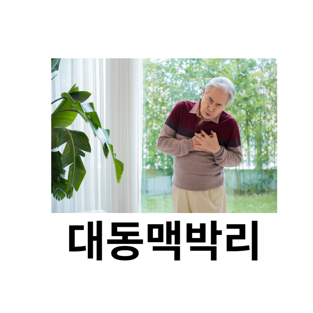 대동맥박리와 관련된 사진입니다.