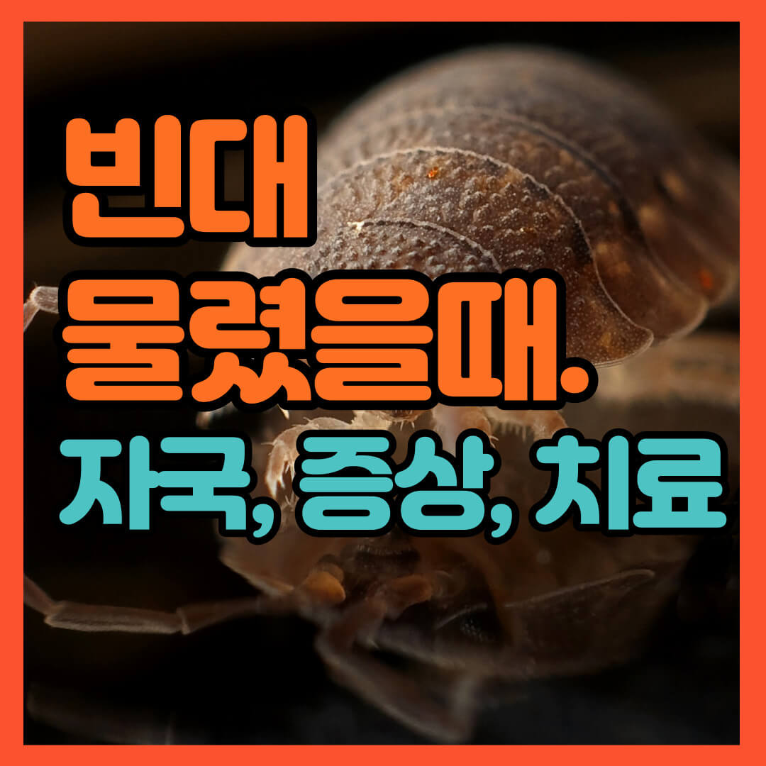 빈대 물린 자국 사진 증상 치료