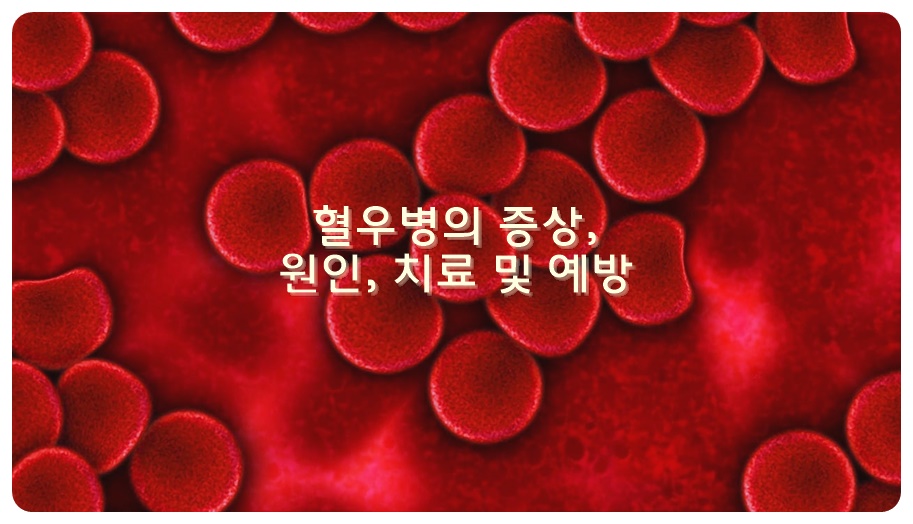 혈우병의 증상&#44; 원인&#44; 치료 및 예방