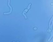 브로멜라인 효능, 부작용, 먹는 법 알아보기