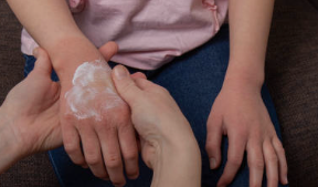 쥐젖 제거 방법 쥐젖 제거 연고 실비보험 비용 쥐젖 패치 종류