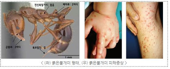 불개미 물림