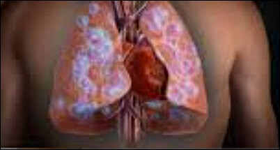 가슴이 벌렁거리는 증상 11