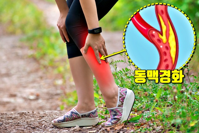 혈압이 높을때 증상, 고혈압 증상, 보행장애, 걸을때 다리가 땡기고 아픈 이유