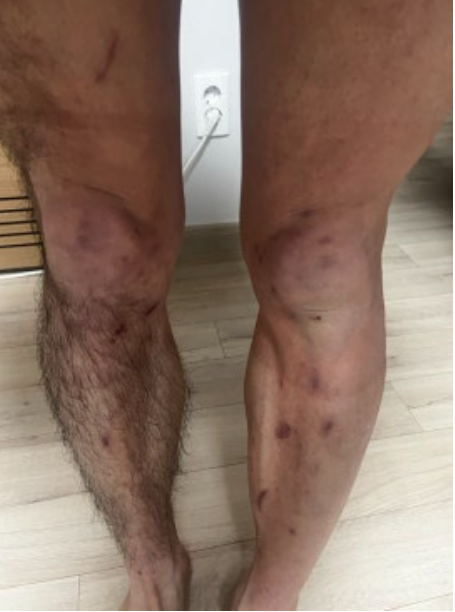 혼바디 바디트리머 실사용 후기 효과