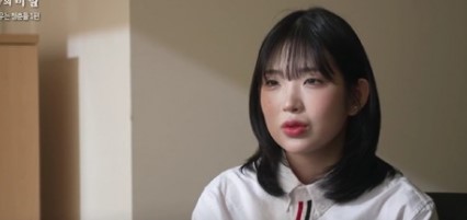 루푸스병 이란 최준희 루푸스 증상 진단 검사 치료 방법 정리