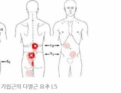 천골 통증 위치와 원인