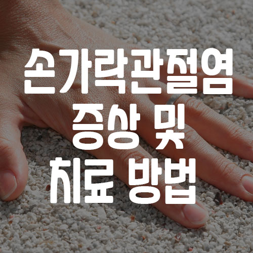 손가락 관절염 증상 및 치료 방법