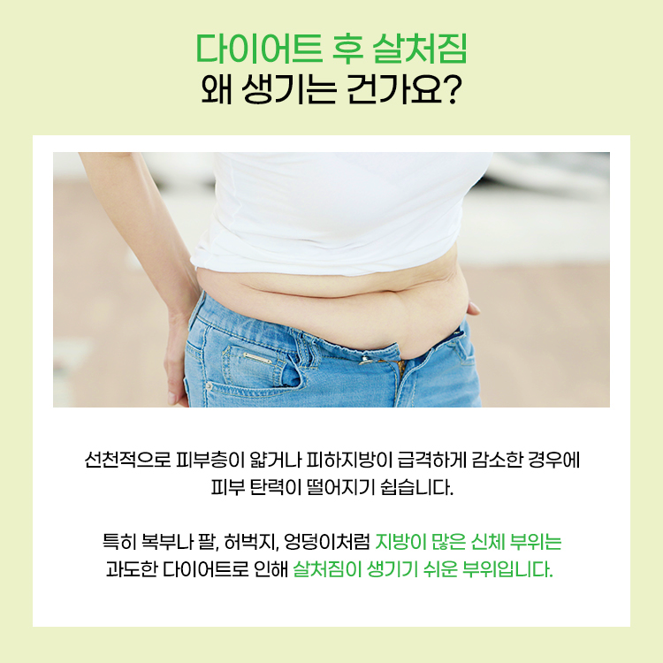 복부나 팔, 허벅지, 엉덩이처럼 지방이 많은 신체 부위는 과도한 다이어트로 인해 살처짐이 생기기 쉬운 부위입니다.