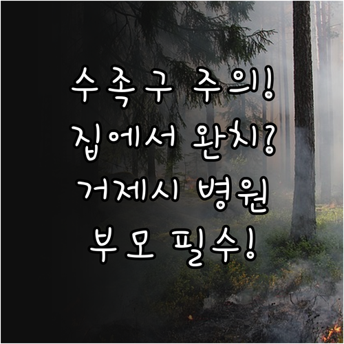 아이 수족구병 집에서 돌보는 방법과 ..