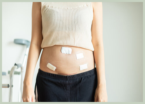 담낭 제거 수술 후 관리 방법