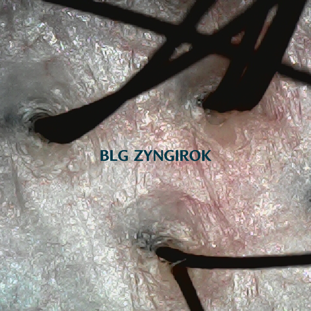 피나모아 복용 21주차 - 뒷머리 두피 모습이다.