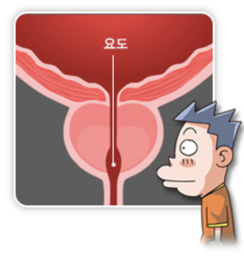 전립선비대증 4