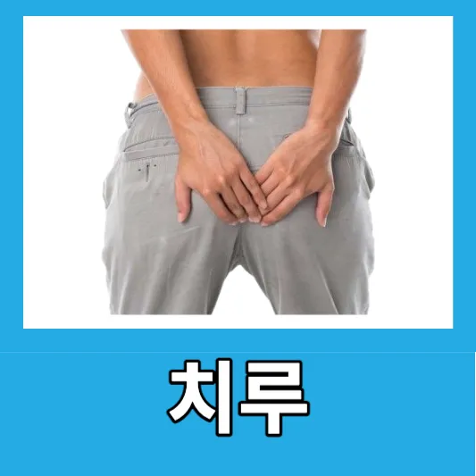 치루
