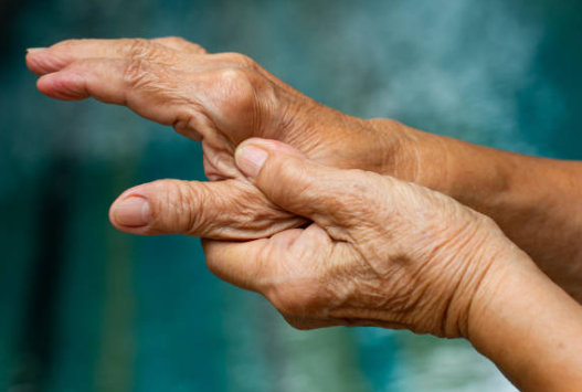 류마티스 관절염 말기