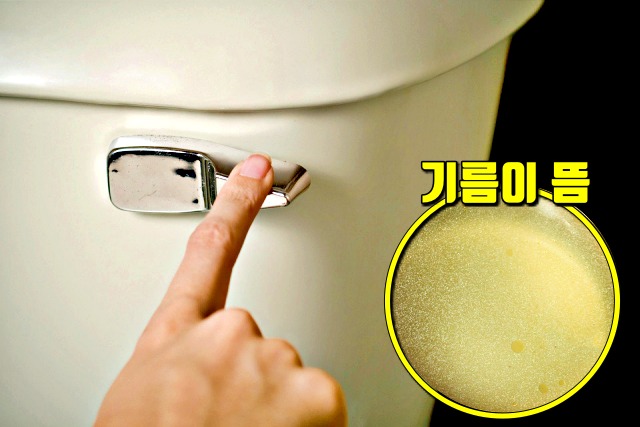 췌장암 증상 대변에 기름,췌장암 초기증상,췌장암 자가진단,팁줌