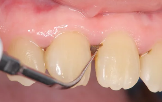 스케일링 이미지/출처:어도비스톡