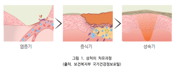 상처지유과정