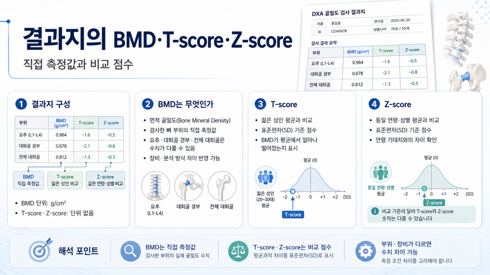 골밀도 결과지의 BMD 측정값과 T-score·Z-score 비교 기준