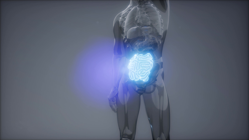 대장암 초기증상