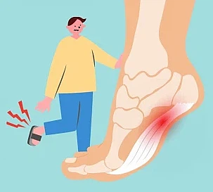 족저근막염