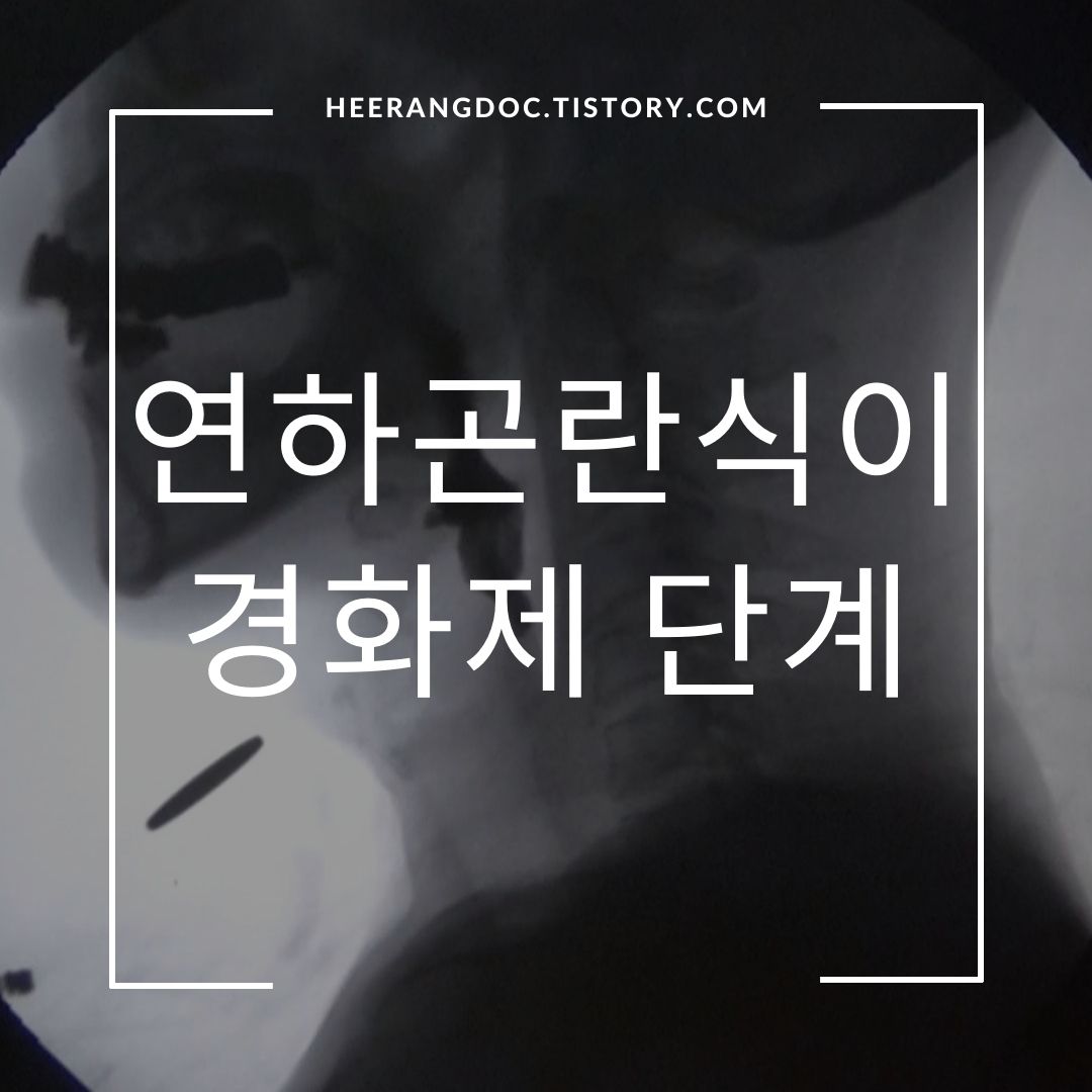 연하곤란식이와 경화제 단계