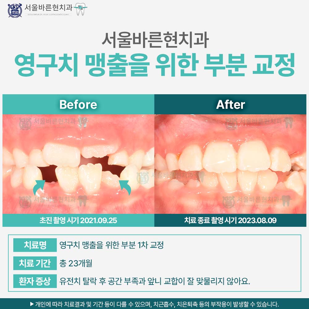 부산교정치과
