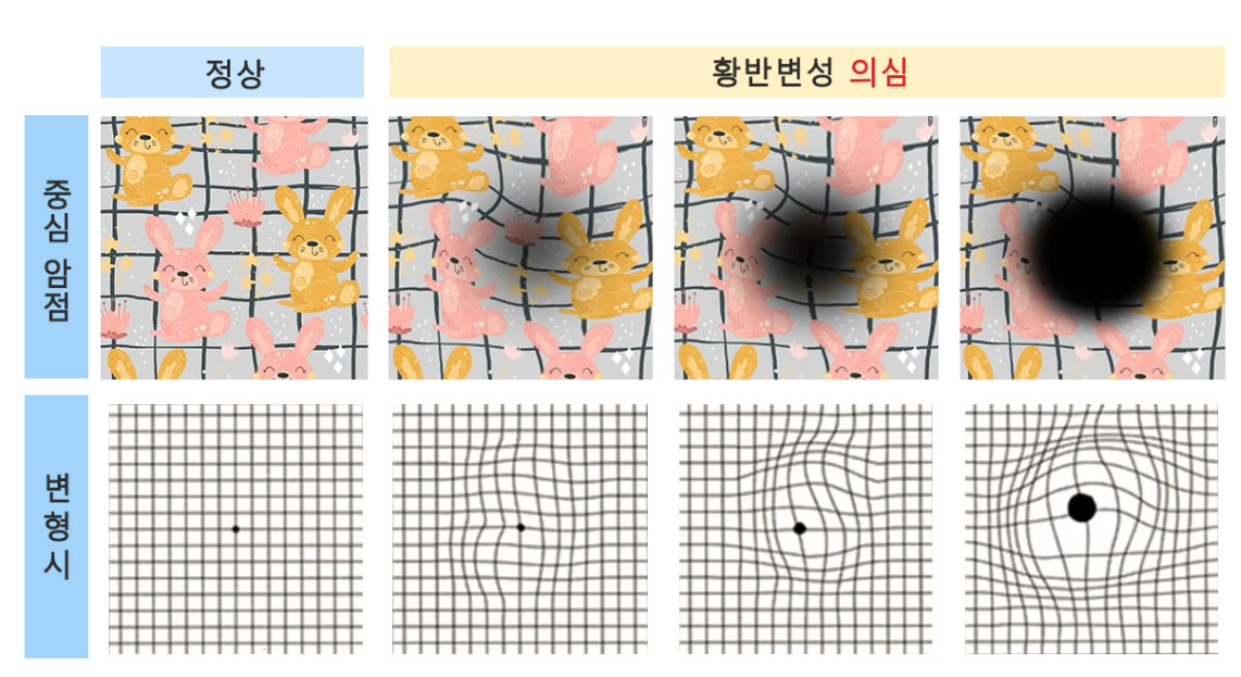 암슬러격자 테스트