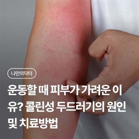 몸이 가려운 이유