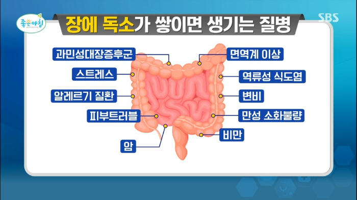 장 독소 테스트 자가진단 질병