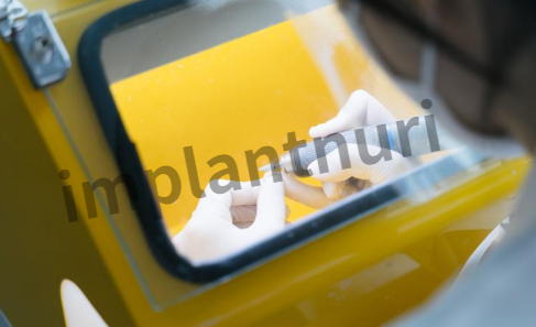 덴티스 임플란트 가격