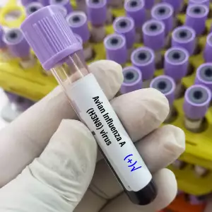 A형 독감 격리 기간