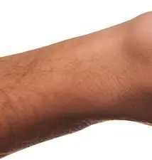 베트남 여행자보험 필수 보장 항목 5가지, 청구 방법