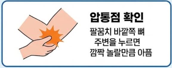 테니스 엘보 치료법