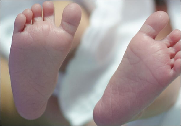 발바닥 통증부위 2