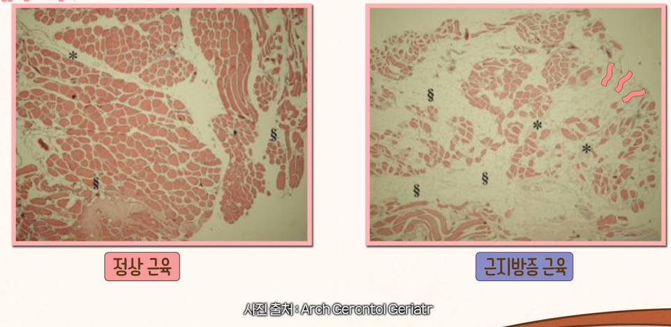 산양유 단백질 효능