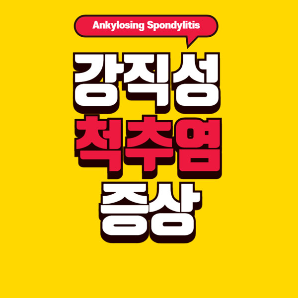 강직성 척추염 증상