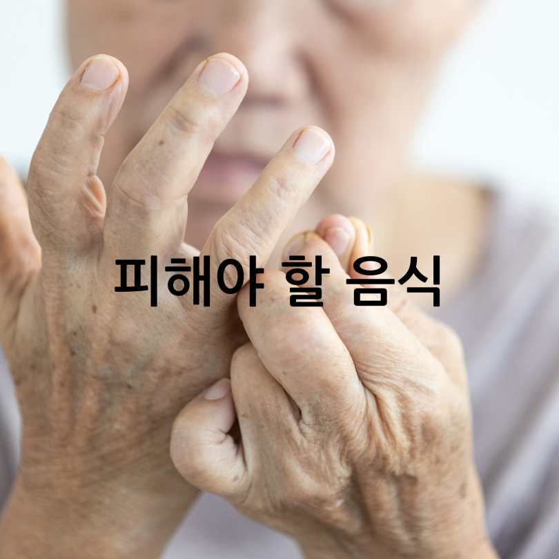 류마티스관절염 증상,식단,운동법
