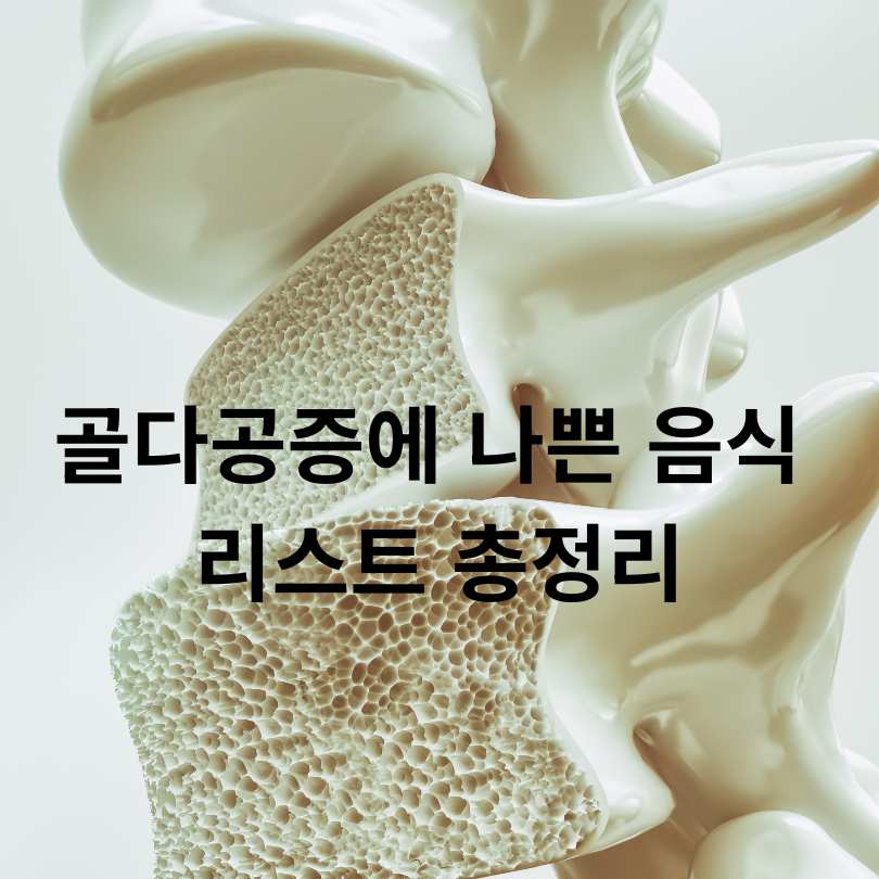 골다공증에 나쁜 음식 리스트 총정리