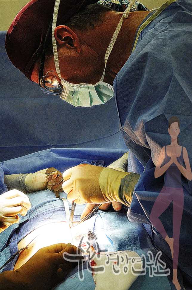 맹장염 초기증상