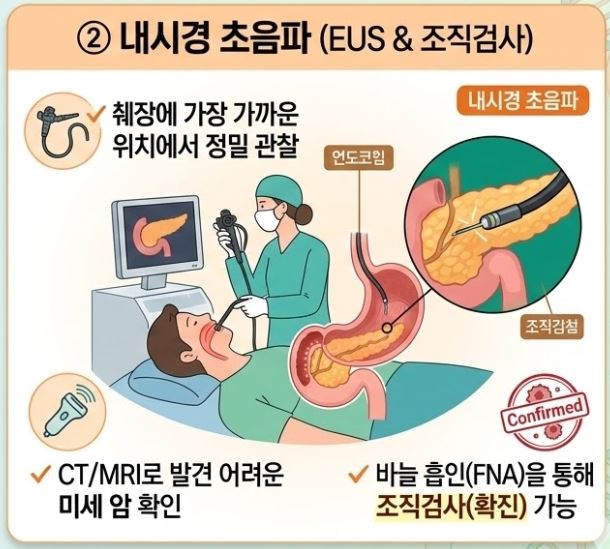 췌장암 검사방법